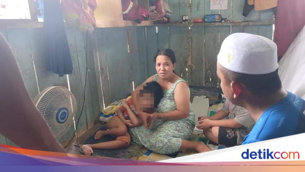 Kondisi Danisa bocah disabilitas di Samarinda yang mengalami patah tulang